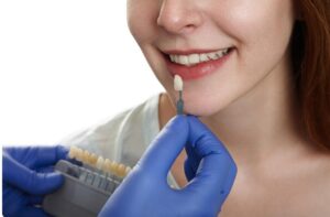 Lentes de resina ou porcelana: qual dura mais?