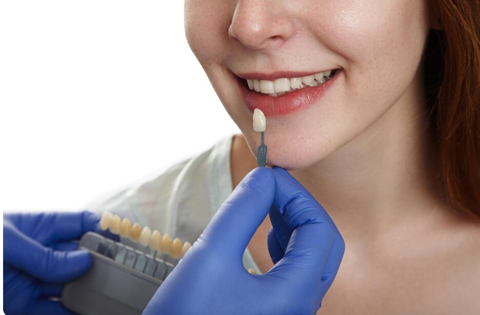 Lentes de resina ou porcelana: qual dura mais?