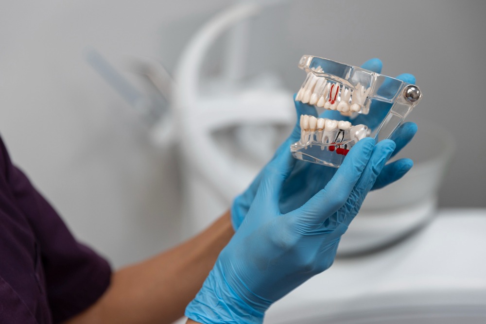 Quanto custa um implante dentário em Brasília?